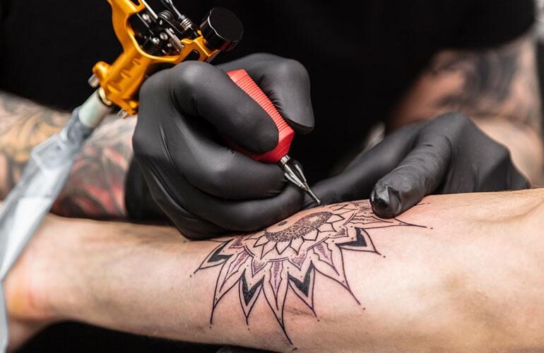 Impeccable Tattoo Removal Service Within Your Budget!